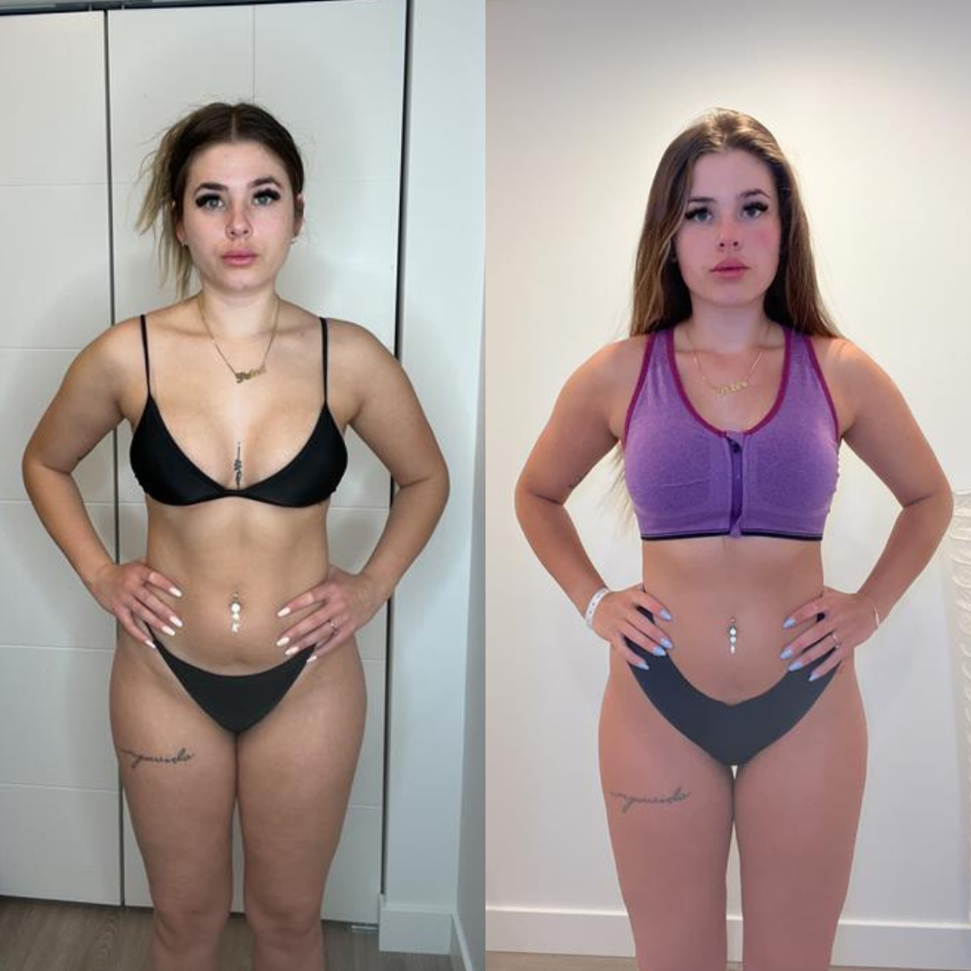 Client transformation — before and after